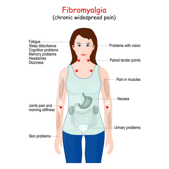 Fibromyalgia symptoms